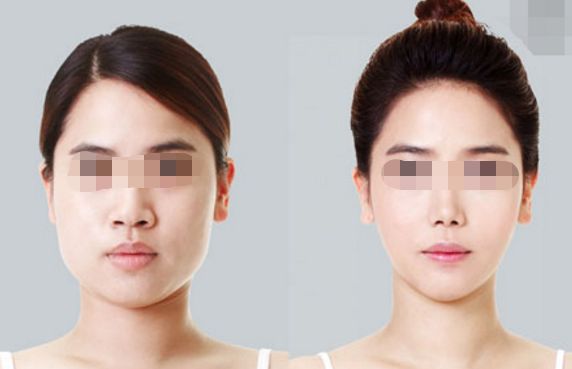 大連哪里可以做陰道緊縮手術(shù)？哪家醫(yī)院的陰道緊縮手術(shù)效果好？