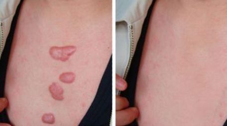 鄭州市哪家美容醫(yī)院好？優(yōu)質(zhì)專業(yè)醫(yī)療服務等你來咨詢！