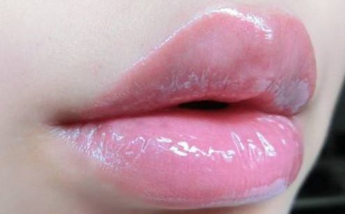 濟南哪家整形醫(yī)院口碑好？