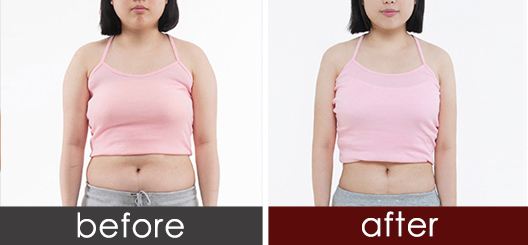 2023汕頭眼角提拉術醫(yī)生TOP10口碑榜(葉昕、陳春娜、李炳輝口碑實力都是上上選)