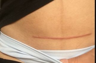 如何選擇新疆做胎記醫(yī)院，哪家好？