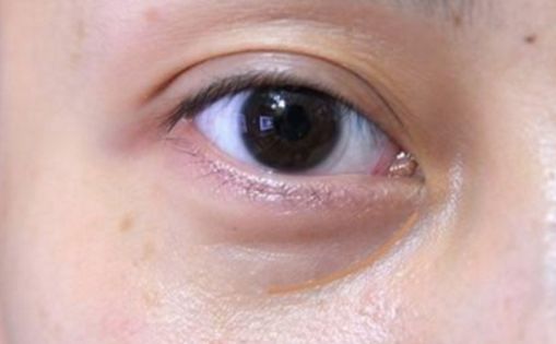 邯鄲哪家醫(yī)院做私密整形好？解析當(dāng)代女性美容訴求