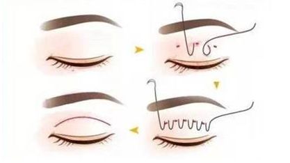 南寧夢(mèng)想醫(yī)療美容門(mén)診部的項(xiàng)目有哪些值得了解的特色？