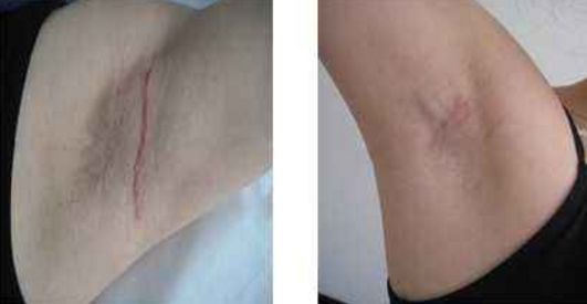 深圳激光美容醫(yī)院排名及口碑哪家好？