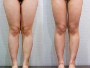 南京眼皮松弛醫(yī)院排名及口碑調(diào)查：哪家醫(yī)院是患者首選？