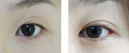 汕頭市整形醫(yī)院有哪些？哪家整形醫(yī)院在汕頭市口碑好？