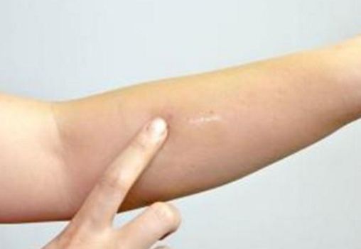 蘇州吸脂瘦身醫(yī)院哪家好？選個最適合你的專業(yè)醫(yī)療機(jī)構(gòu)