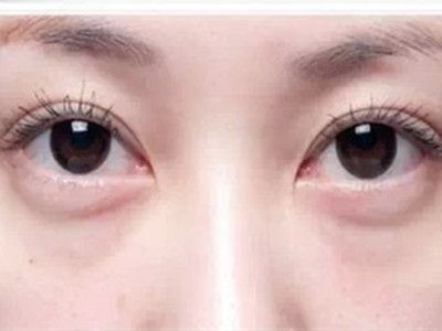 寧波祛斑哪家醫(yī)院好？精選寧波祛斑專業(yè)醫(yī)院推薦！