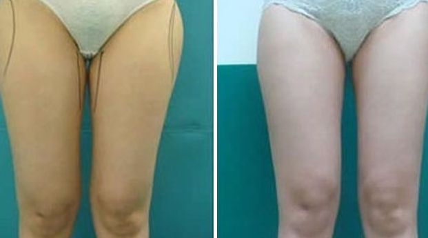 揭陽激光美容醫(yī)院哪家好？選擇揭陽最佳激光美容醫(yī)院的7個關(guān)鍵要素！