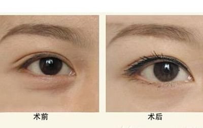 寧波隆鼻Top5醫(yī)生：技術(shù)精湛，聲譽(yù)卓越，口碑贊不絕口！