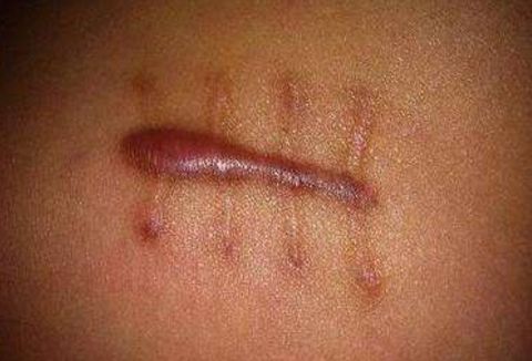 貴陽胎記治療醫(yī)院的名氣有哪些？