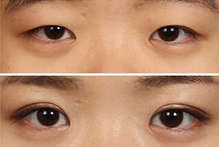 2023北京射頻瘦腰權(quán)威醫(yī)生上榜TOP10(趙英利、常青、尹林實力口碑專業(yè)點評)