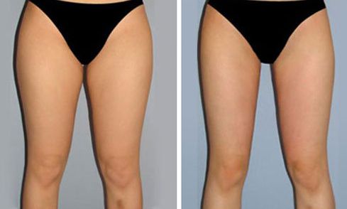 重慶美萊整形美容醫(yī)院口碑如何？醫(yī)生名單和特色項目都有什么？