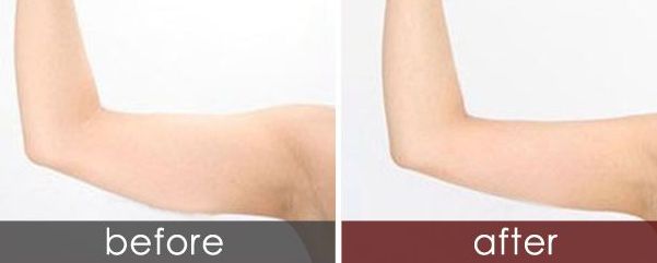 長(zhǎng)春狐臭手術(shù)哪家醫(yī)院最專業(yè)？選擇哪家醫(yī)院治療狐臭效果好