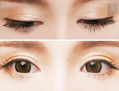 西寧豐胸整形醫(yī)院排名前三，專業(yè)醫(yī)生推薦！