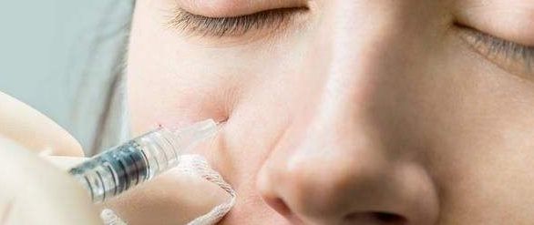 西安哪家醫(yī)院激光去斑效果最好？