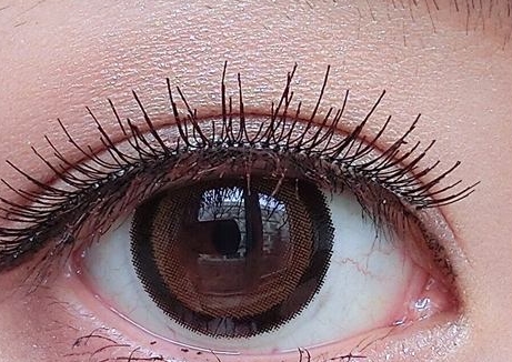 2023珠海上瞼皺紋榜上前10名醫(yī)生(李尚旭、李金瓊、李德新是當(dāng)?shù)乩吓扑搅?