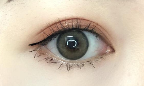 北京空軍總醫(yī)院整形科，雙眼皮手術(shù)醫(yī)生推薦，備受好評，咨詢電話