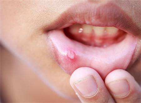 2023杭州注射膠原蛋白隆鼻排名前幾的醫(yī)生(潘虹、吳晶琰、熊麗優(yōu)質(zhì)醫(yī)生任你選擇)