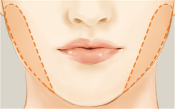 寧波海曙美萊醫(yī)療美容整形醫(yī)院醫(yī)生技術(shù)靠譜嗎？手術(shù)項(xiàng)目有哪些呢？