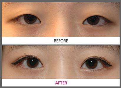 2023烏魯木齊長痘點陣激光排名榜前十專家(王春利、吳京慶、張偉實力鎖定榜一_推薦收藏)