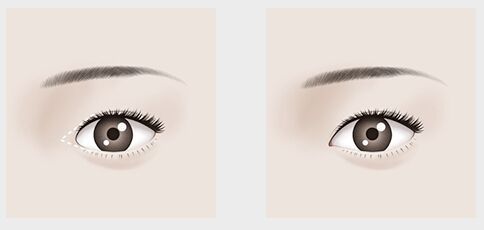 北京整形三甲醫(yī)院哪家好？優(yōu)秀的北京整形三甲醫(yī)院有哪些？