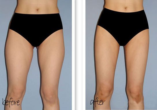 合肥隆鼻好整形醫(yī)院是哪家？綜合口碑來(lái)推薦！