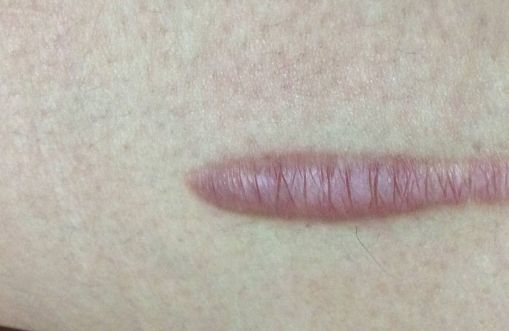 南京有哪些值得推薦的較正規(guī)美容醫(yī)院？