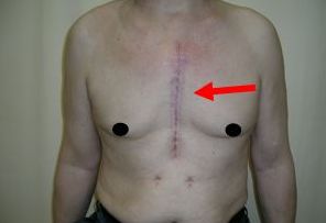 福州果酸換膚哪家醫(yī)院好？