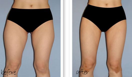 南京哪家醫(yī)院除雀斑好？醫(yī)院雀斑治療排名及效果對比！