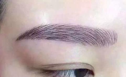 2023年脂肪填充領(lǐng)域的醫(yī)師鄧東偉與趙尤軍，自體脂肪移植技術(shù)的新潮流