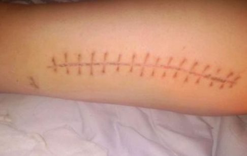 水光針武漢三甲醫(yī)院哪家好？如何選擇適合自己的水光針服務醫(yī)院