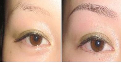 湖北哪家醫(yī)院治療團結(jié)口好呢？