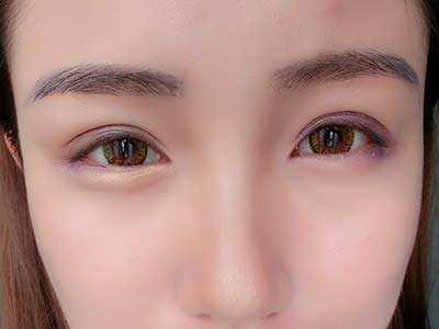 2023鄭州消除頸部皺紋醫(yī)生推薦前十位(梁博文、黃普利、王新燦人氣大咖介紹一覽！)