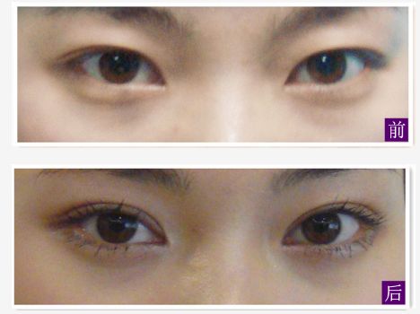 求推薦南寧哪家整形醫(yī)院好？讓你輕松找到靠譜的整容醫(yī)院