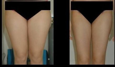 南京做拉皮哪家醫(yī)院好？排名靠前的南京做拉皮醫(yī)院有哪些？