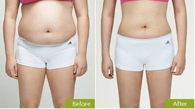 上海美聯(lián)臣整形醫(yī)院蔡豐州最新眼袋整形技術(shù)評(píng)測(cè)