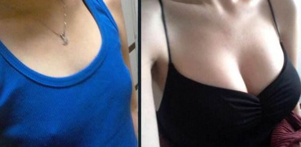 福州鼻梁手術哪家醫(yī)院好？淺析福州頂級整形醫(yī)院鼻部整形技術