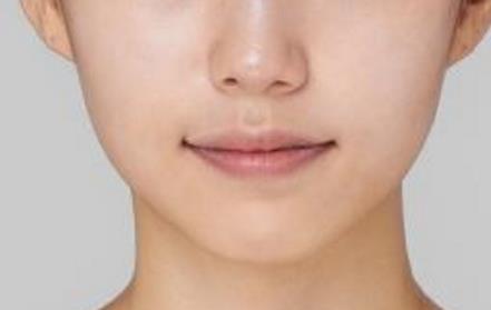 2023濟(jì)南膠原蛋白注射墊額頭醫(yī)生排名榜top10強(qiáng)(平金磊、黃志祥、王玉柱干貨帖收藏)