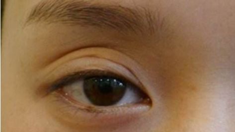 悅美整形醫(yī)院是否是合規(guī)醫(yī)療機(jī)構(gòu)？資質(zhì)概述與名醫(yī)坐診引薦獲??？