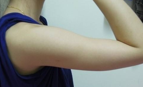 趙寅局拉皮：口碑何如？經(jīng)歷、擅長(zhǎng)和用戶反饋來(lái)說(shuō)話！