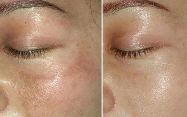 廣州領(lǐng)銜！全新發(fā)布隆鼻專家排行榜！盤點(diǎn)醫(yī)生資料！