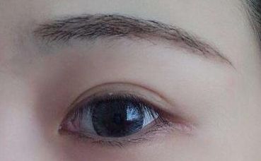 【2023年最新】鄭州哪家雙眼皮醫(yī)院口碑好、技術(shù)高？！