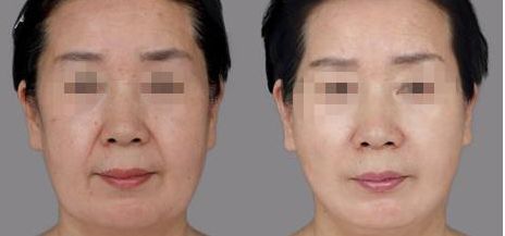 海口哪家醫(yī)院做微創(chuàng)好？全面解析?？谖?chuàng)手術技術領先的醫(yī)院