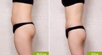 廣州雙眼皮手術(shù)哪家醫(yī)院好？專家推薦的地標(biāo)醫(yī)療機(jī)構(gòu)一覽