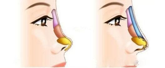 全國哪家醫(yī)院祛斑好？10家值得信賴的專業(yè)醫(yī)院推薦