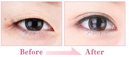 2023新鄉(xiāng)玻尿酸去除黑眼圈權(quán)威醫(yī)生評分TOP10(魏作明、井素芳、魏作明實力口碑沒一個差的)