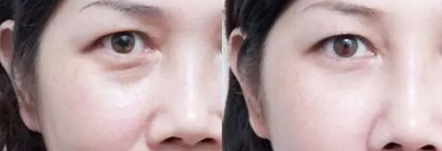 保定市整形外科哪家好？2023年最新榜單及專家推薦！