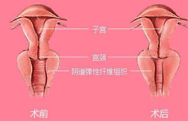 長沙靠譜矯正醫(yī)院哪家好？解答你所有的疑慮！