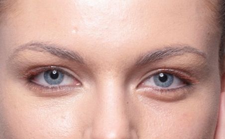 深圳哪家醫(yī)院的埋線減肥效果最好？